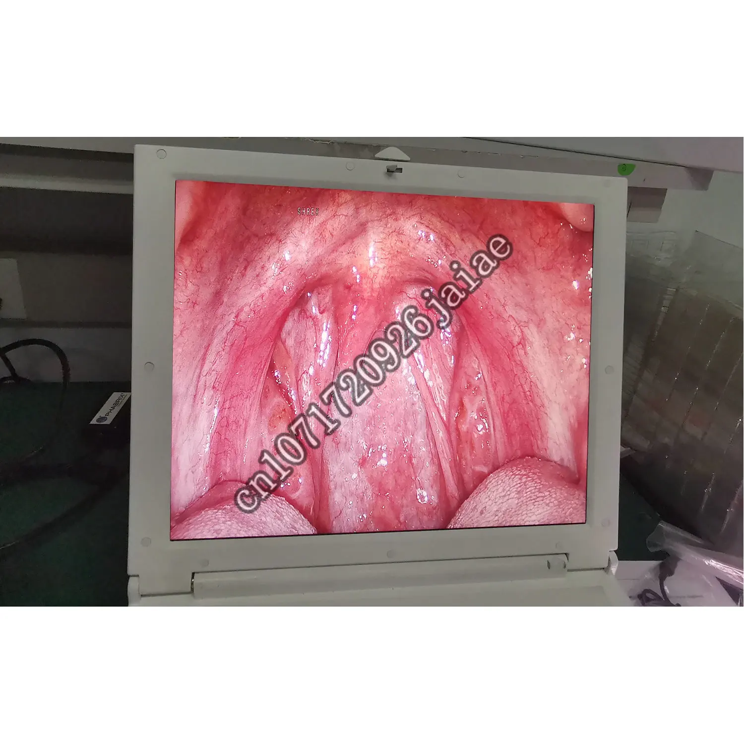 Portátil médica de cirugía laparoscópica arthroscopi artroscópica de la artroscopia . ' - ' . 2